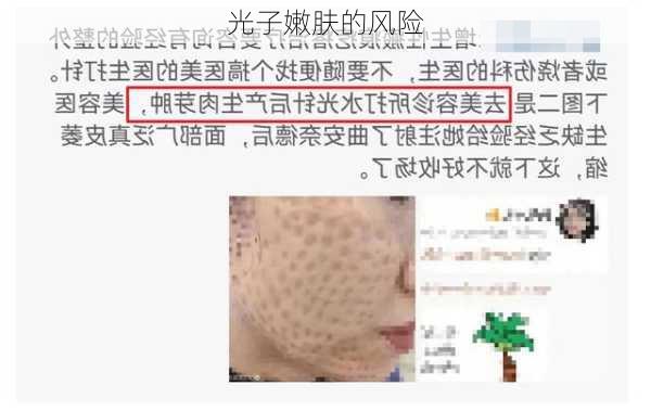 光子嫩肤的风险