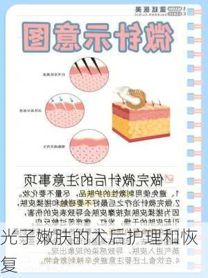 光子嫩肤的术后护理和恢复