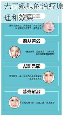 光子嫩肤的治疗原理和效果