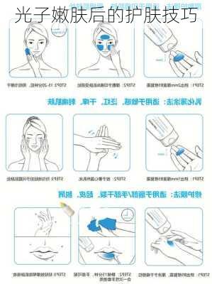 光子嫩肤后的护肤技巧