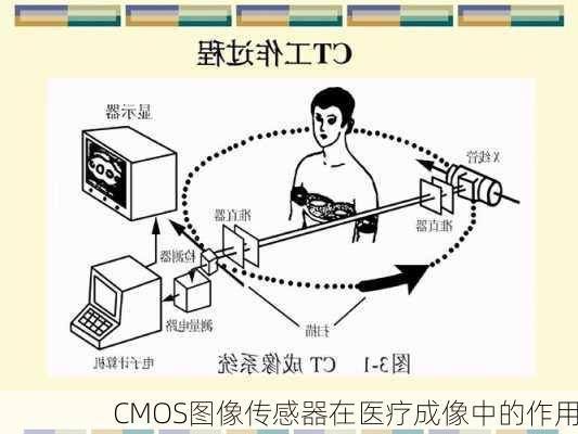 CMOS图像传感器在医疗成像中的作用