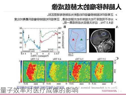量子效率对医疗成像的影响