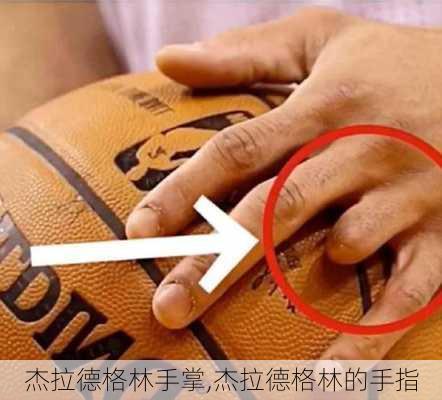 杰拉德格林手掌,杰拉德格林的手指