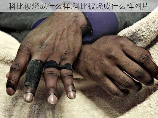 科比被烧成什么样,科比被烧成什么样图片